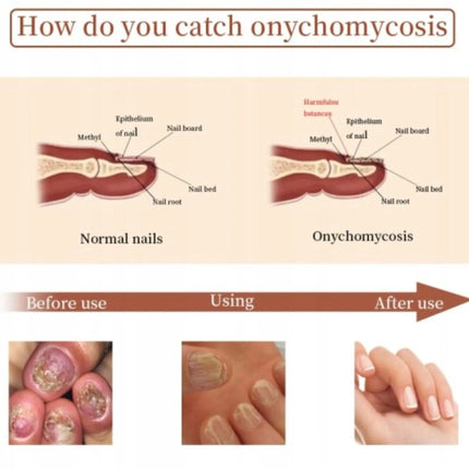 Antibakterinis skystis su nagų atstatymu ir augimo skatinimu – 20 ml - Beauty Kit