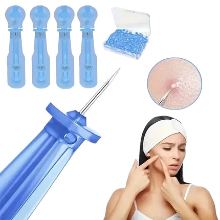 Vienkartinės adatos spuogams šalinti ir inkštirų šalinimo rinkinys