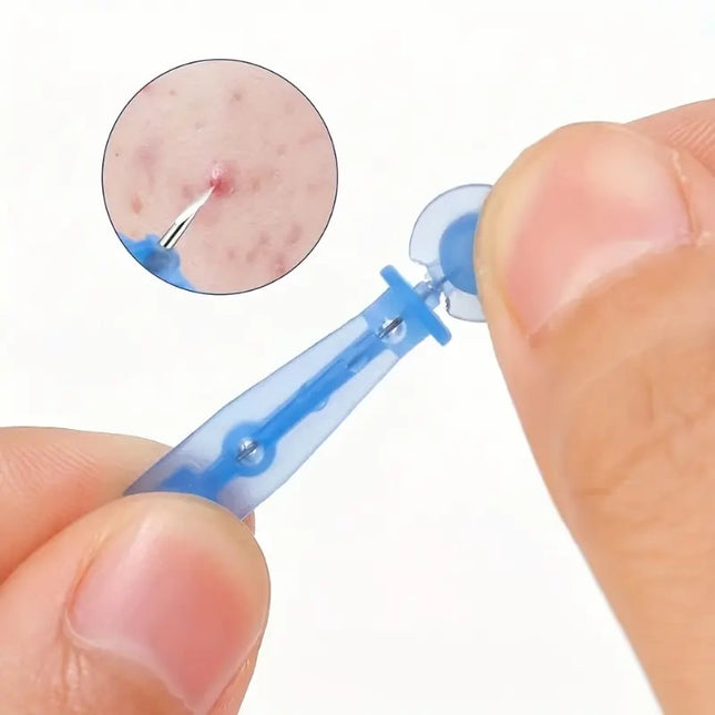 Vienkartinės adatos spuogams šalinti ir inkštirų šalinimo rinkinys