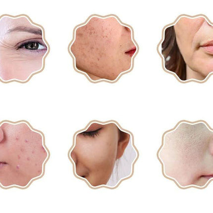 Šviesos terapijos kaukė Anlan - Beauty Kit