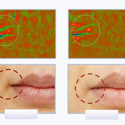 Ultragarsinis veido masažuoklis su šviesos terapija ANLAN - Beauty Kit