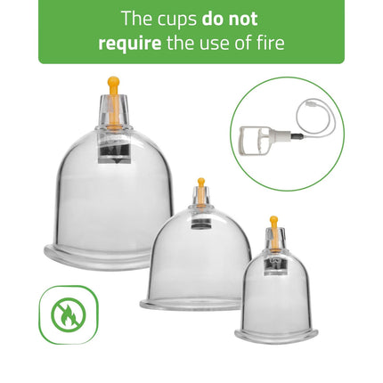 HABYS Vacuum Massage Cups with Pump, Set of 24 - another view